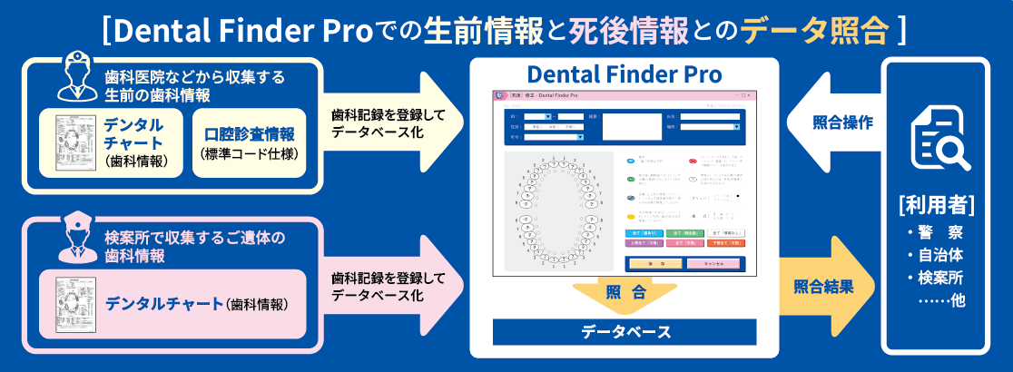 Dental Finder® Pro